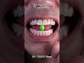 Satisfying Chewing ASMR #Compilation #ASMR #DoctorTristanPeh