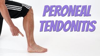 Peroneal Tendonitis (Side of Foot Pain), Causes & SelfTreatment.