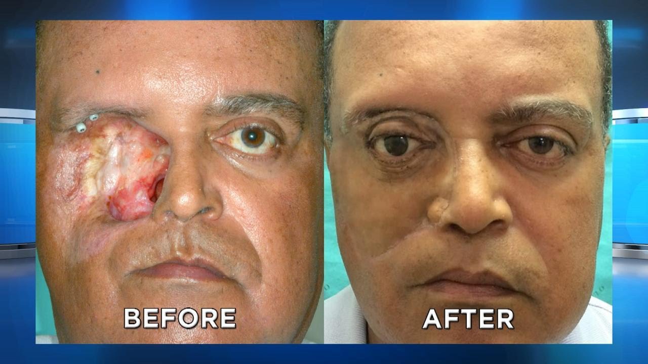 3D Printed Face Created with Smartphone?!