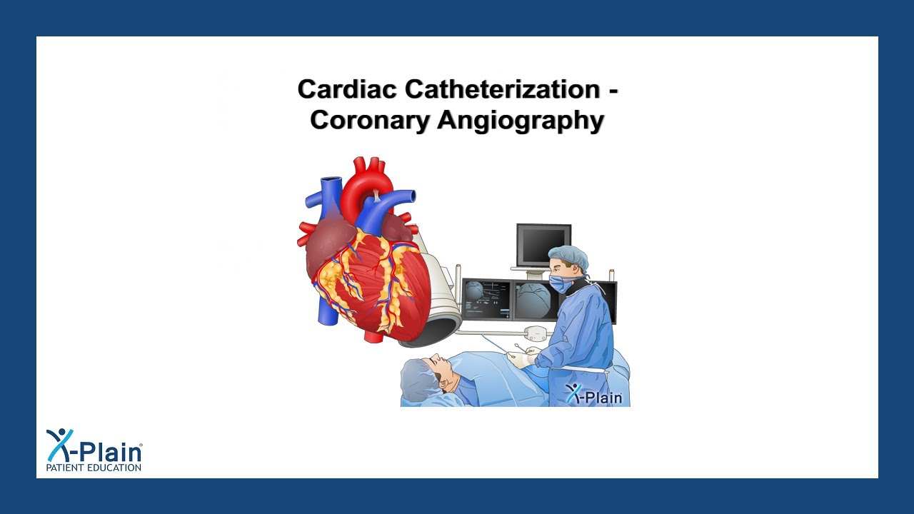 Cardiac Catheterization Coronary Angiography YouTube