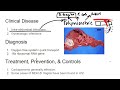 Gram Negative Rods  Bacteroidies fragilis