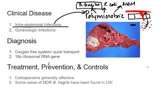 Gram Negative Rods Bacteroidies fragilis