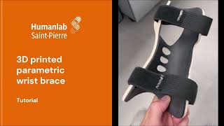 3D PRINTED OPEN-SOURCE PARAMETRIC WRIST BRACE (TUTORIAL)