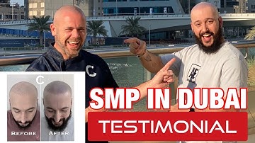 SMP Testimony in Dubai 2020 | Creative Scalps | Scalp MicroPigmentation