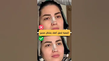 طريقة وضع لصقات الانف بعد التجميل تجميل الأنف تجميل 