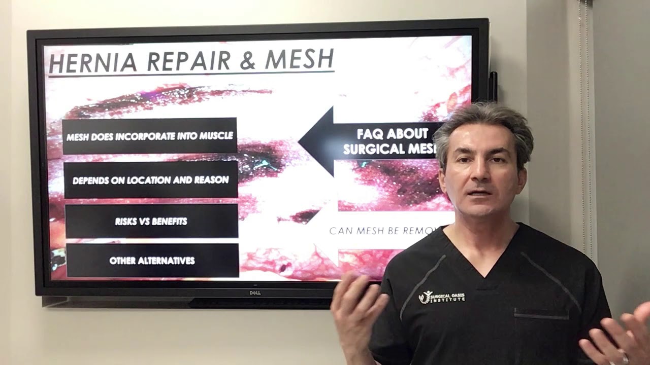 Can surgical mesh be removed? by Dr. Iraniha