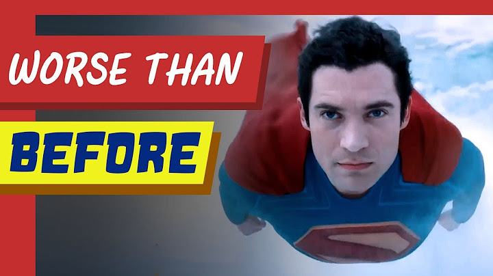 They Fixed Superman’s Eyes… But Broke EVERYTHING Else