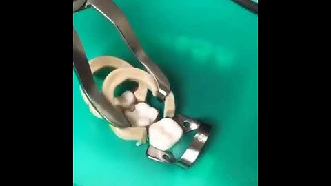 How to use Resin ring sectional matrix