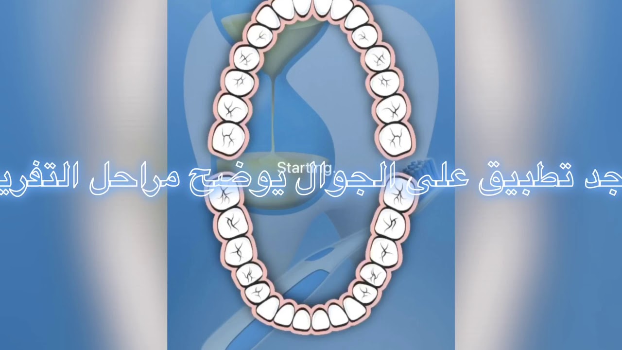 كيفية تفريش الاسنان مع جهاز التقويم