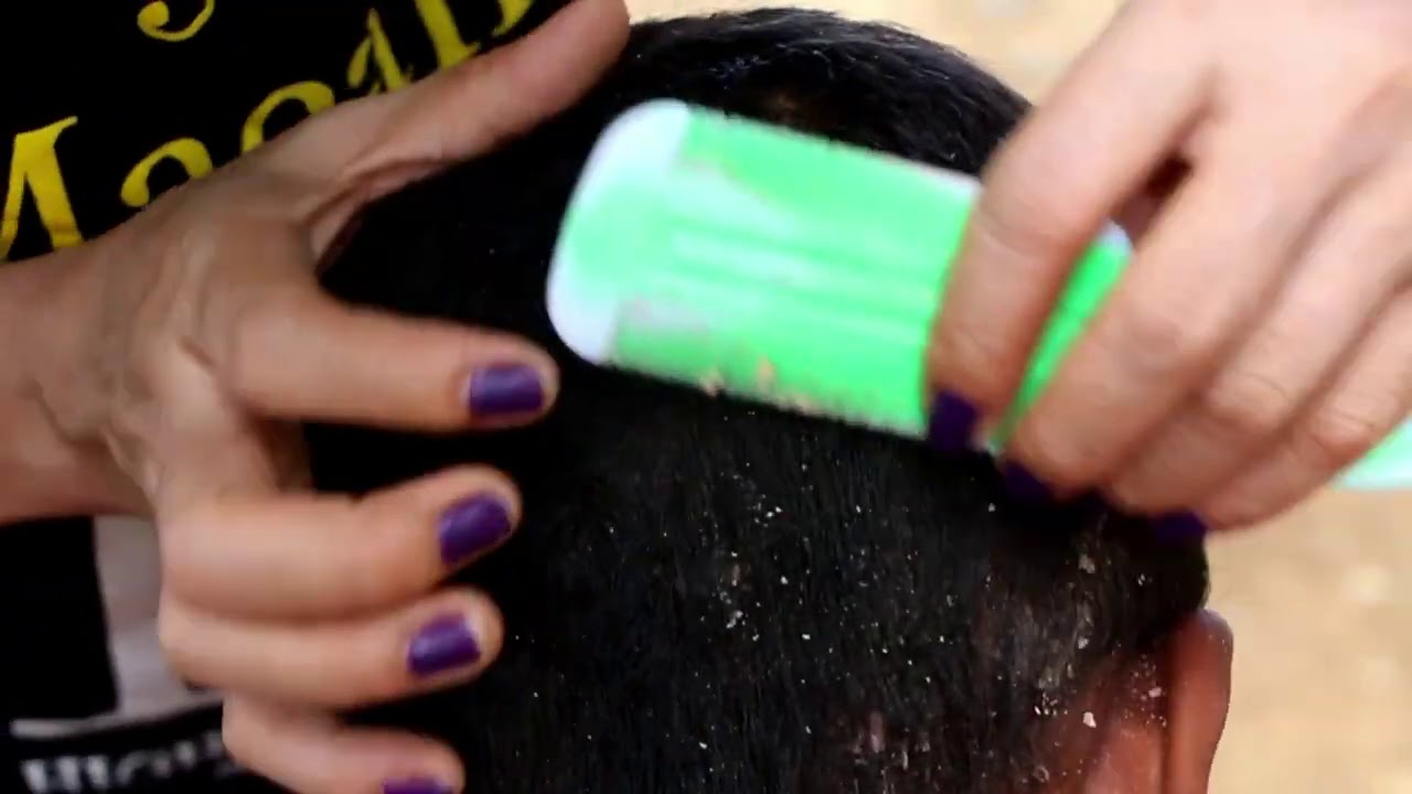 Comb Dandruff and catching lice for children YouTube