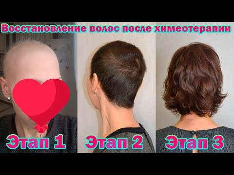 Выпадают волосы после химиотерапии/история рак яичников/ окрашивание волос после болезни