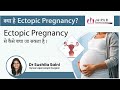 About ectopic pregnancy in detail  dr sushila saini  jaipur doorbeen hospital