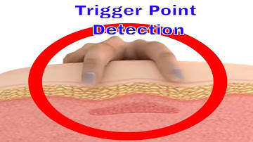 Trigger Point Detection