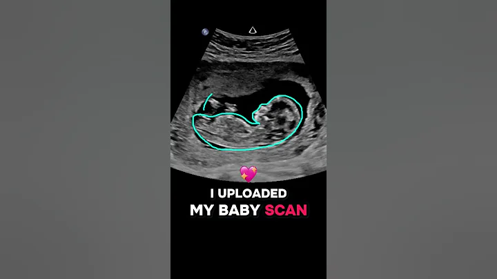 Gender reveal with NubX!