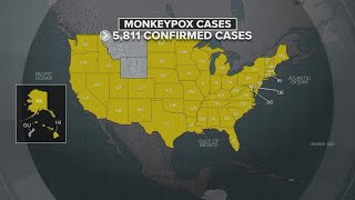 Monkeypox updates: Biden appoints White House response team