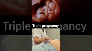 healthy triple baby viral love doctor