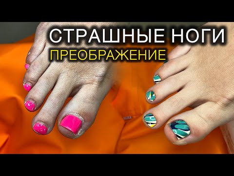 НЕКРАСИВЫЕ НОГИ  #педикюр #пленкивпедикюре #аленалаврентьева #подолог #дизайнногтей