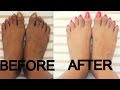 DIY Pedicure At Home / Dark Brown Tan Feet / minniedas