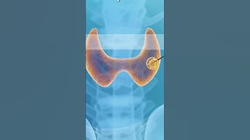 Symptoms of Thyroid Nodules Explained | Maven Medical Center