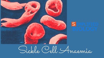 Sickle Cell Anaemia for NEET, AIIMS, AIPMT, MCAT, JIPMER, PREMED
