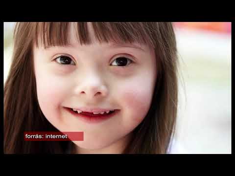 Videó: Down-szindróma - A Down-szindróma Okai, Tünetei, Formái és Kezelése