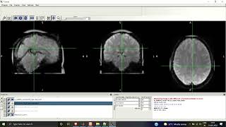 Celebrity Normalization to the MNI Space and Smoothing | SPM | Resting-State fMRI | Preprocessing | MATLAB Wealth