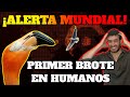 ¡ALERTA MUNDIAL!: PRIMER BROTE DE GRIPE AVIAR H5N8 EN HUMANOS| ¿NUEVA PANDEMIA?