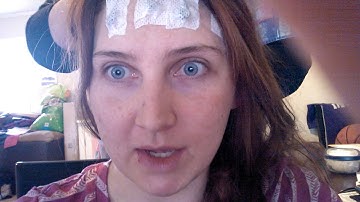 Day one of 72 hour EEG