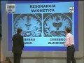 Cómo identificar si padeces Alzheimer