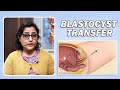 Day 3 cleavage stage or day 5 blastocyst embryo transfer  which is better
