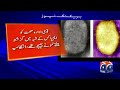 Mpox Confirmed in 41-Year-Old Woman at PIMS | Hospital Administration