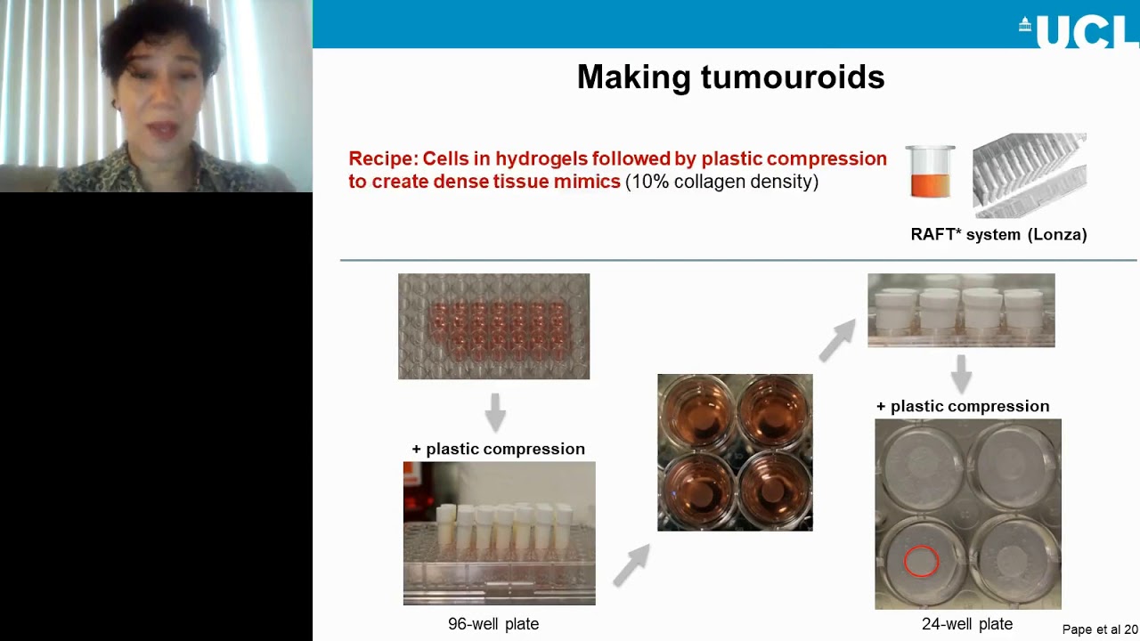 Using 3D in vitro tumoroids for personalized medicine
