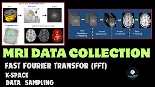 Mri data collection| K- space & FFT | All about Radio| Hindi