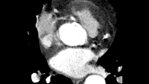 STR Cardiothoracic Case Webinar 10/20/2022