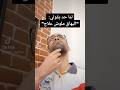 لما حد يقولي البهاق ملوش علاج
