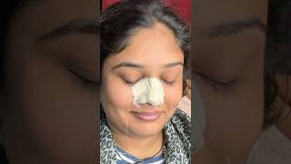 How to remove nose black and white heads / #waxing #hairremoval #skincare #waxingexpert #beauty #wax