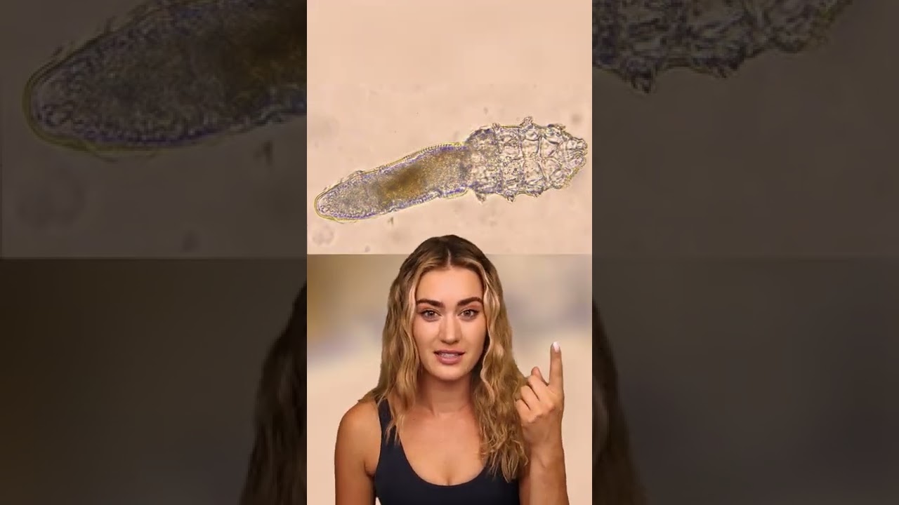 This Bug Is On Your Face Right Now 