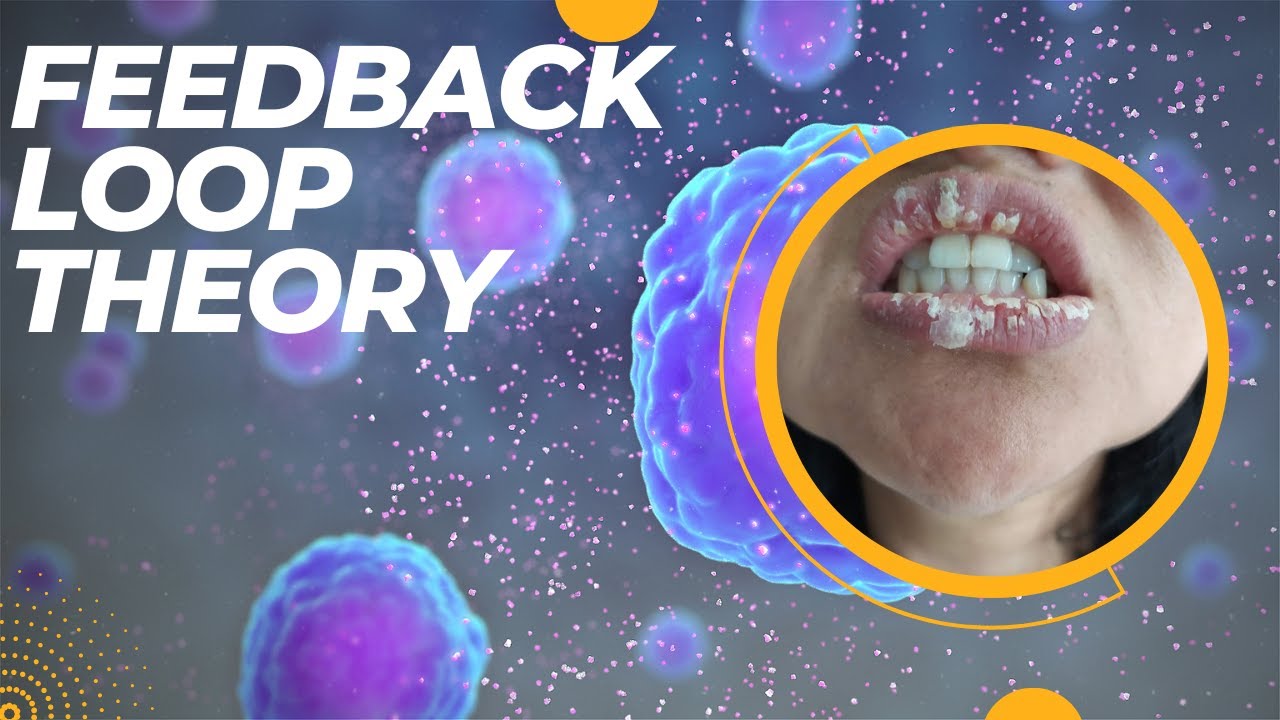 Understanding Exfoliative Cheilitis The Feedback Loop Theory YouTube