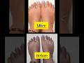 DIY Pedicure at Home ✨💅 | Salon Results on a Budget! #SelfCare #BeautyTips#shorts #pedicure #beauty