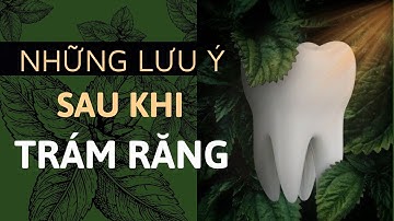 Những lưu ý sau khi trám răng | Tt niềng răng quốc tế Diamond