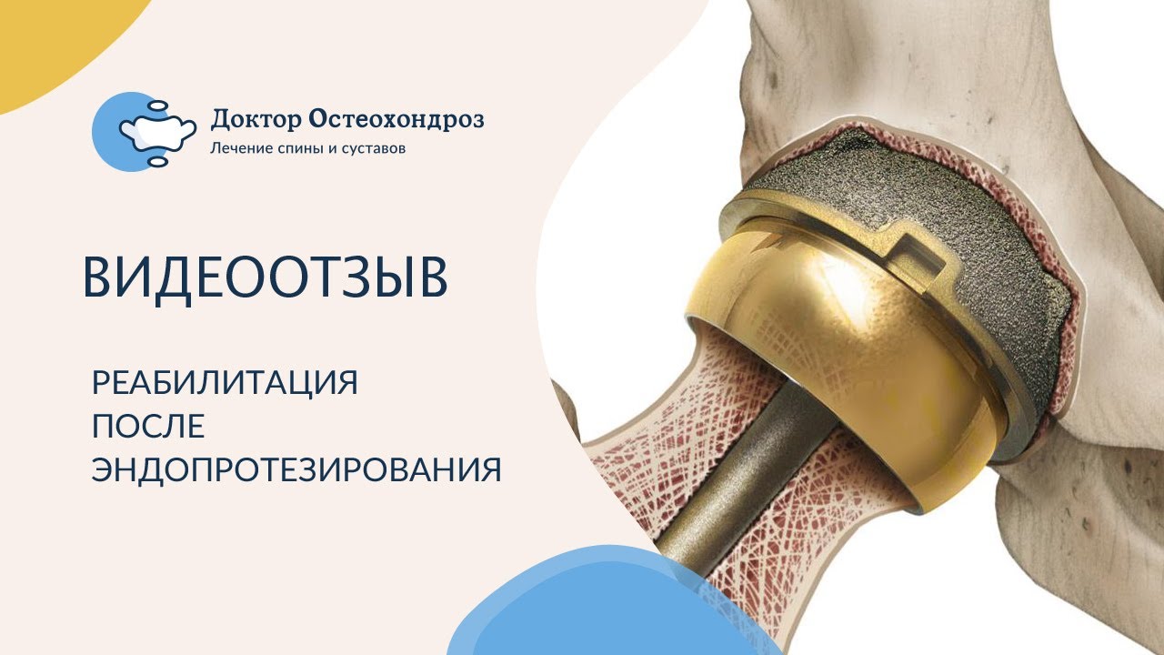 Эндопротез коленного сустава. Протезирование коленного сустава. Операция по замене колена. Коленный эндопротез stryker. Тотальное эндопротезирование коленного сустава цементная фиксация.