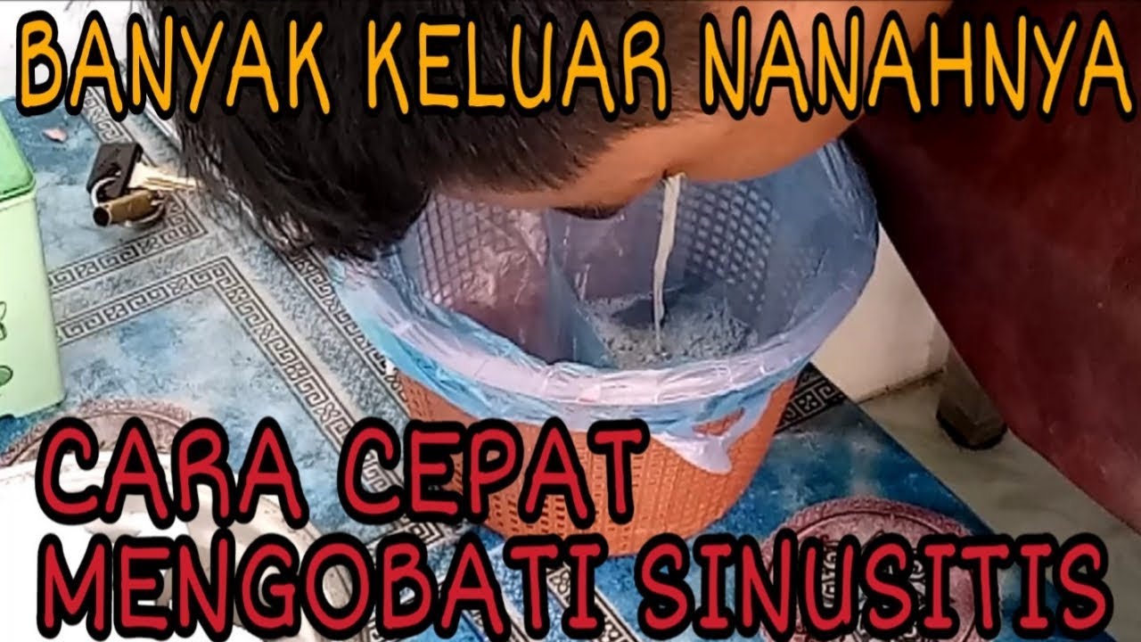 Cara cepat mengobati sinusitis