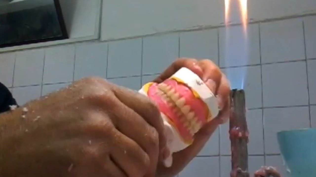 Montage du prothèse total.