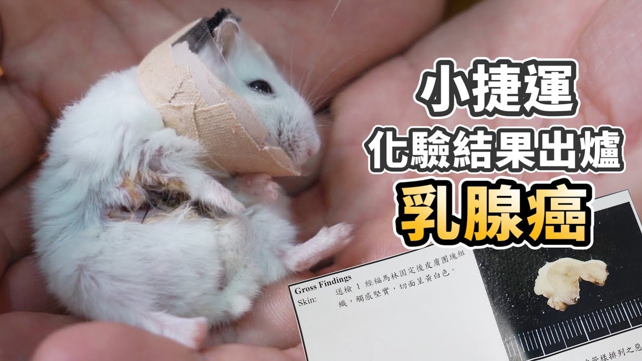 小捷運化驗出爐－乳腺癌【許伯簡芝】