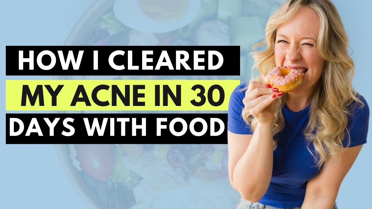 How I cleared my acne in 30 days with food