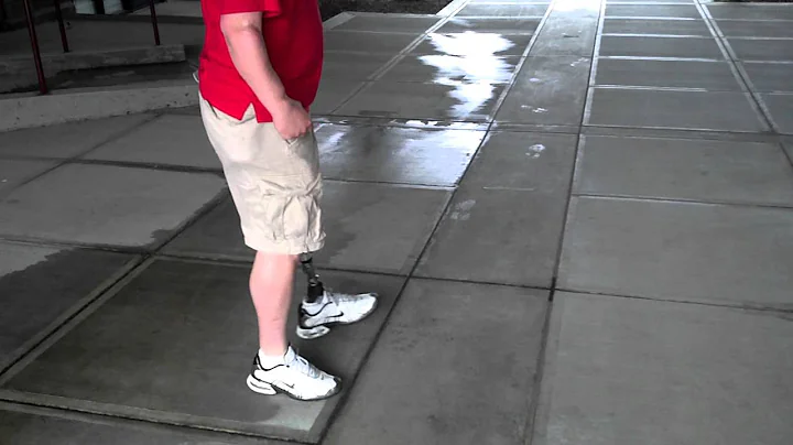 Unilateral Patient on Plie 2.0