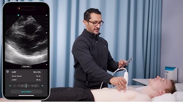 Revolutionizing Cardiac Care with Exo Iris™: Handheld Ultrasound & AI Integration
