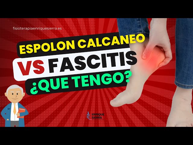 Fascitis plantar y espolón 