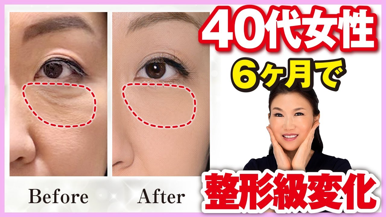 【目の下のブヨブヨ脂肪】40代女性が2ヶ月でここまで若返った方法！老けて見える“たるみ目元”が引き上がる究極のリフトアップ術