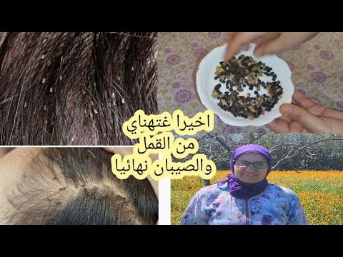 This Head Pill Will Rid You Of Lice And Nits Permanently Try It And See For Yourself It S The B 